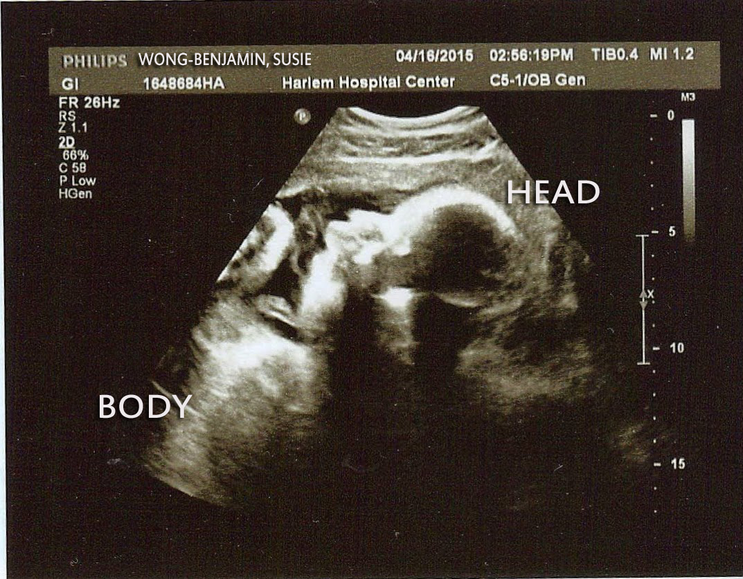 Baby Benjamin profile at age 34 weeks 1 day